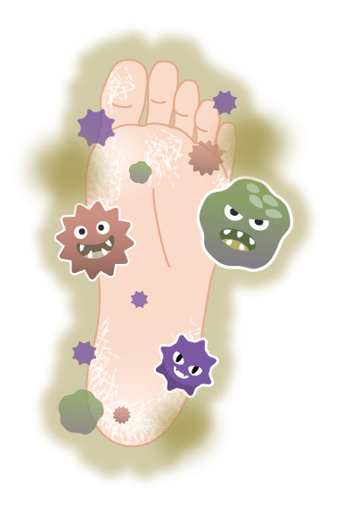 乾燥して菌だらけの足