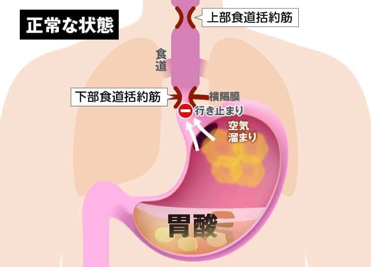 胃が正常な状態