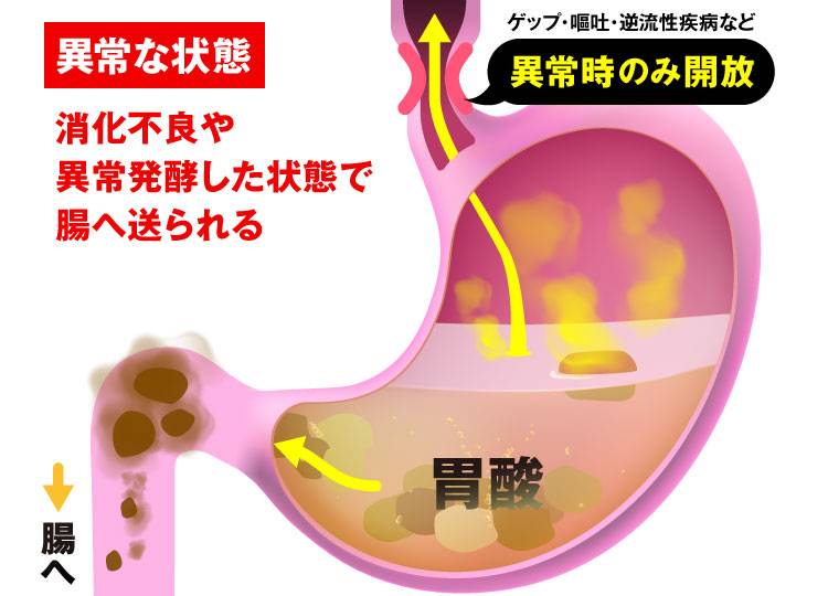 胃が悪い状態