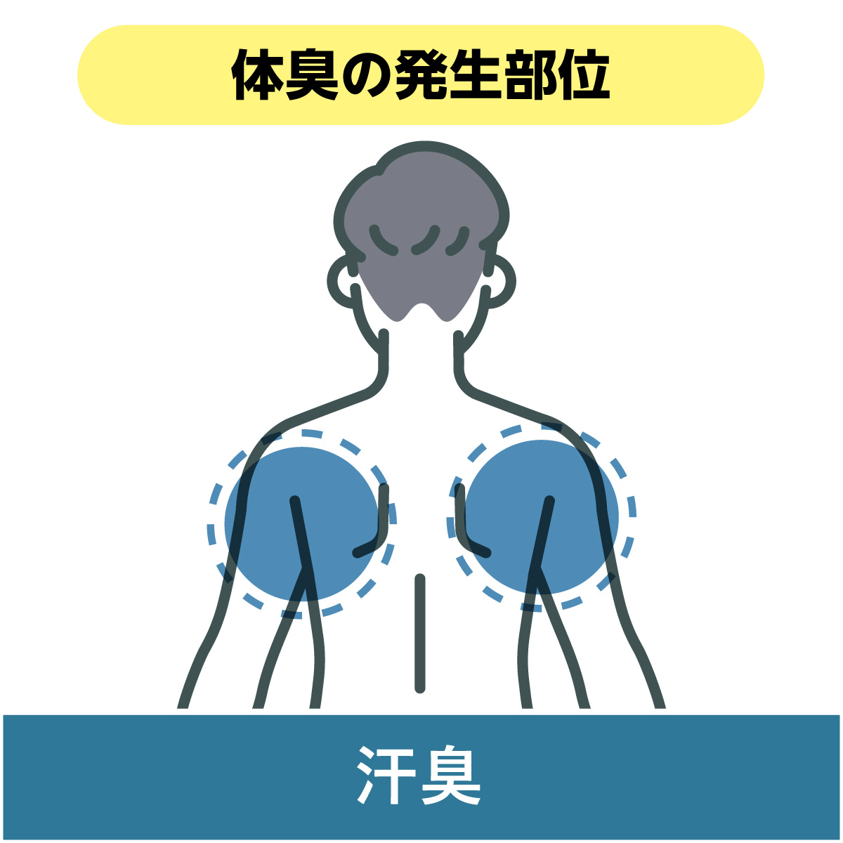 体臭の発生部位－汗臭－