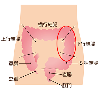 便秘解消マッサージ　左腹をほぐす