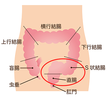 便秘解消マッサージ　下腹部をほぐす