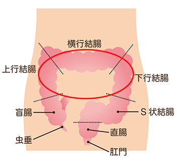 便秘解消マッサージ　大腸を押し上げる