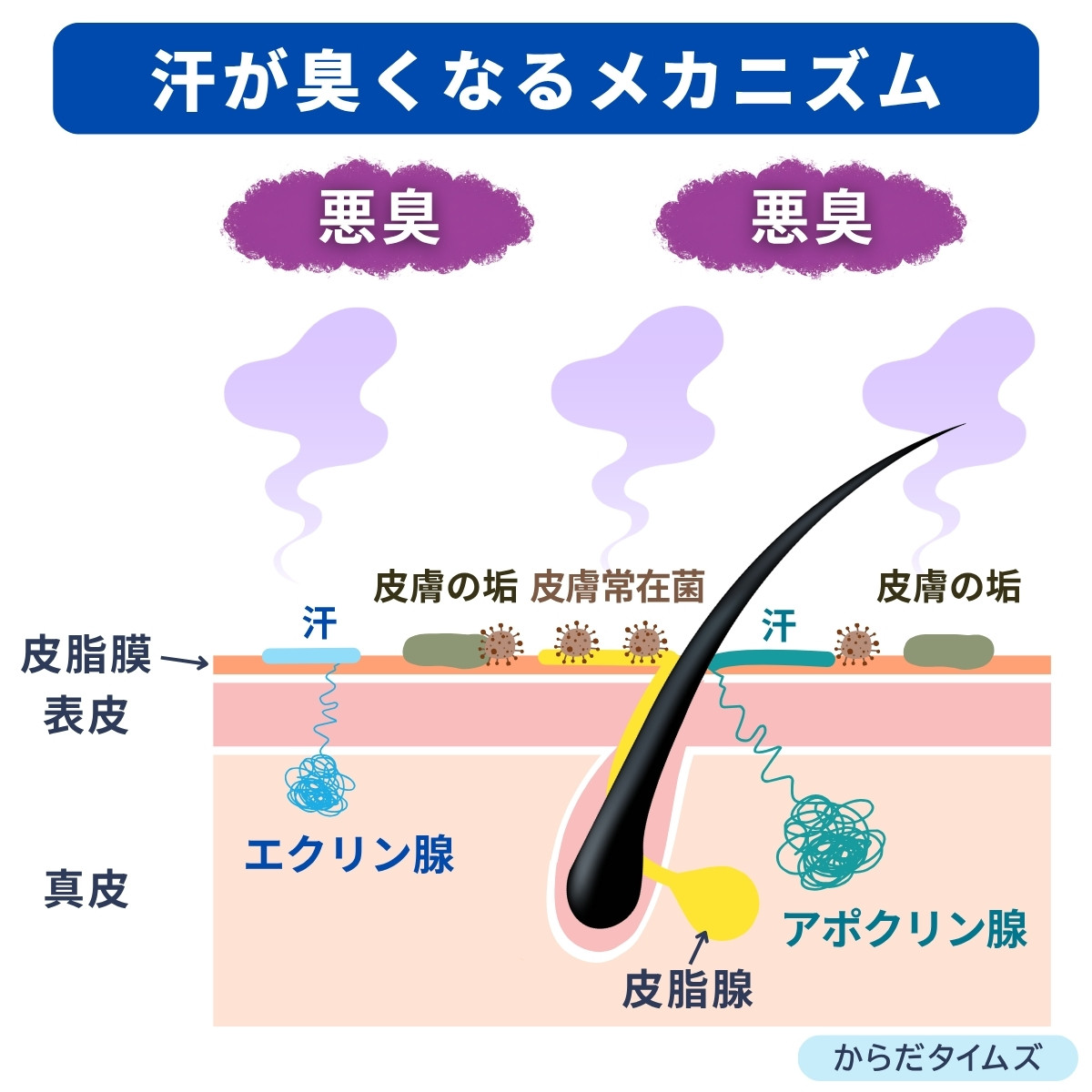 汗が臭くなるメカニズム