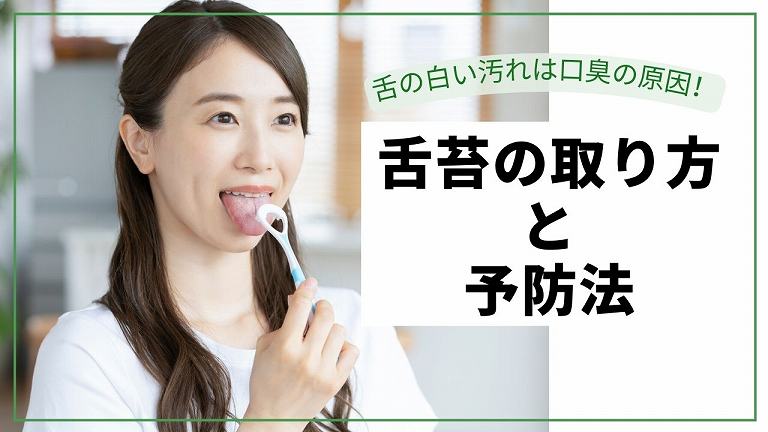 舌苔の取り方と予防法を解説。舌の白い汚れは口臭の原因に