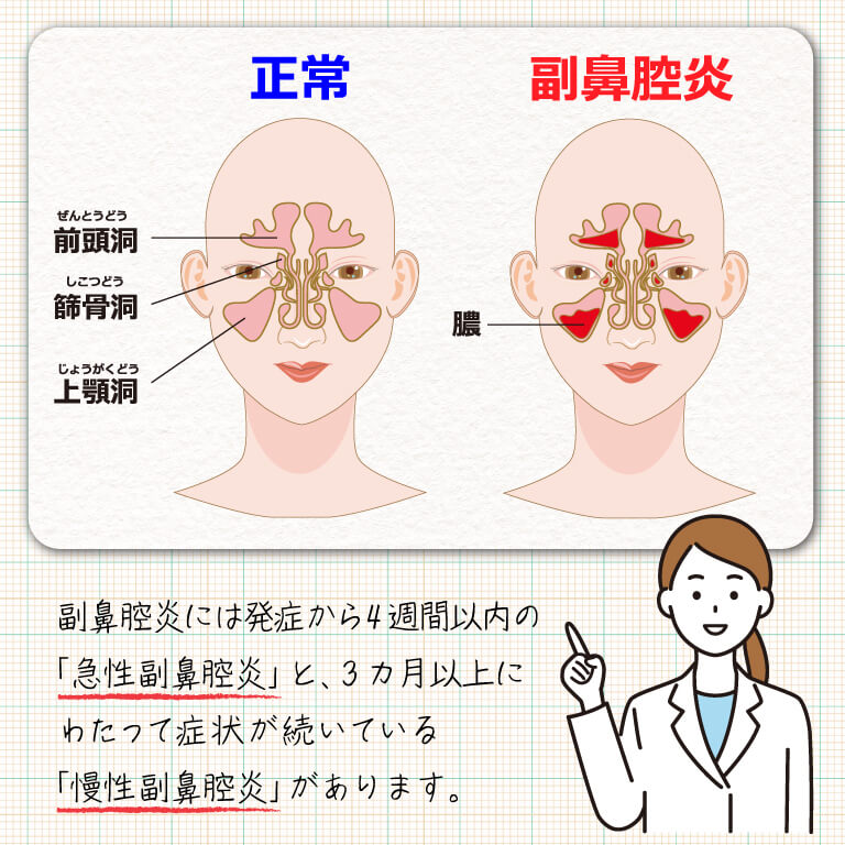 副 鼻腔 炎 歯 が 痛 すぎる