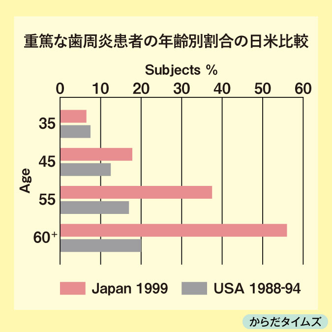 グラフ　重篤な歯周炎患者の年齢別割合の日米比較