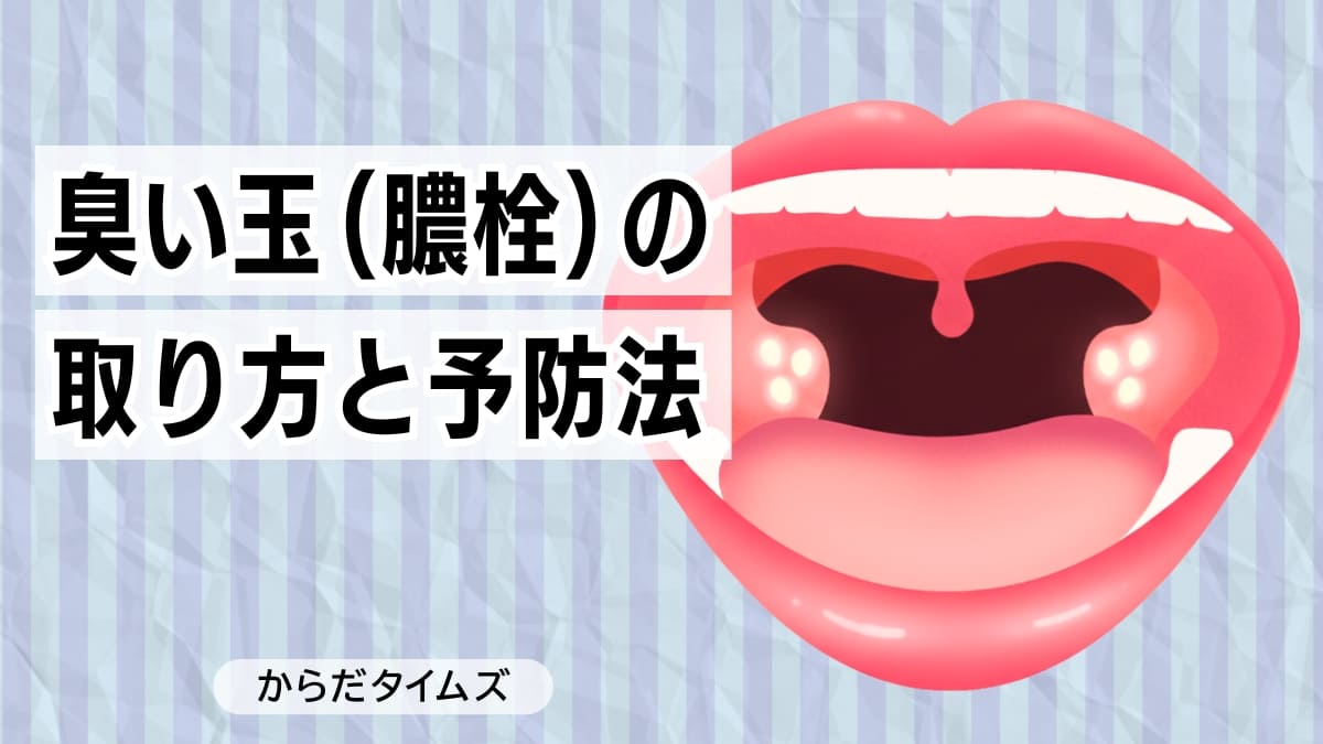 臭い玉（膿栓）の取り方と予防法｜喉の奥が臭い原因