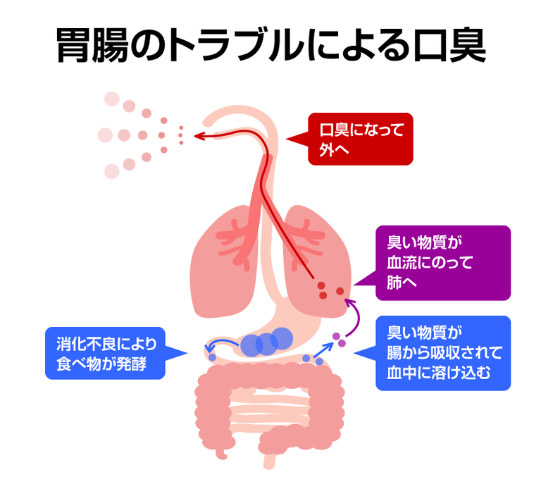 胃腸の不良が口臭になるメカニズム