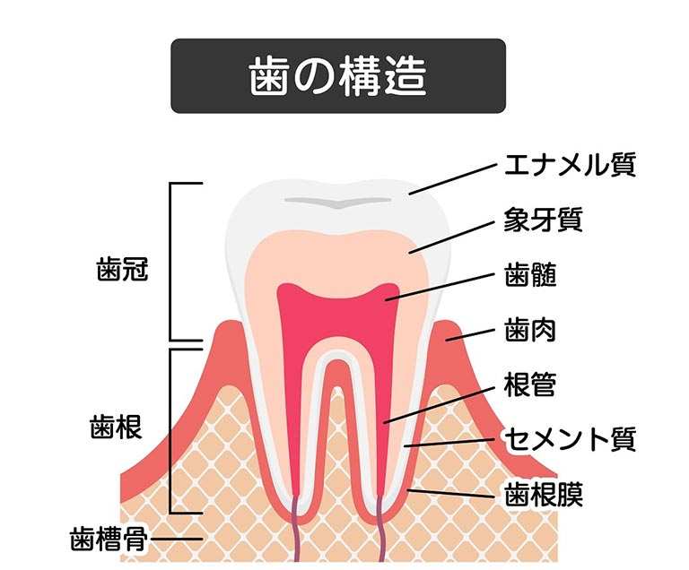 口臭と虫歯の関係