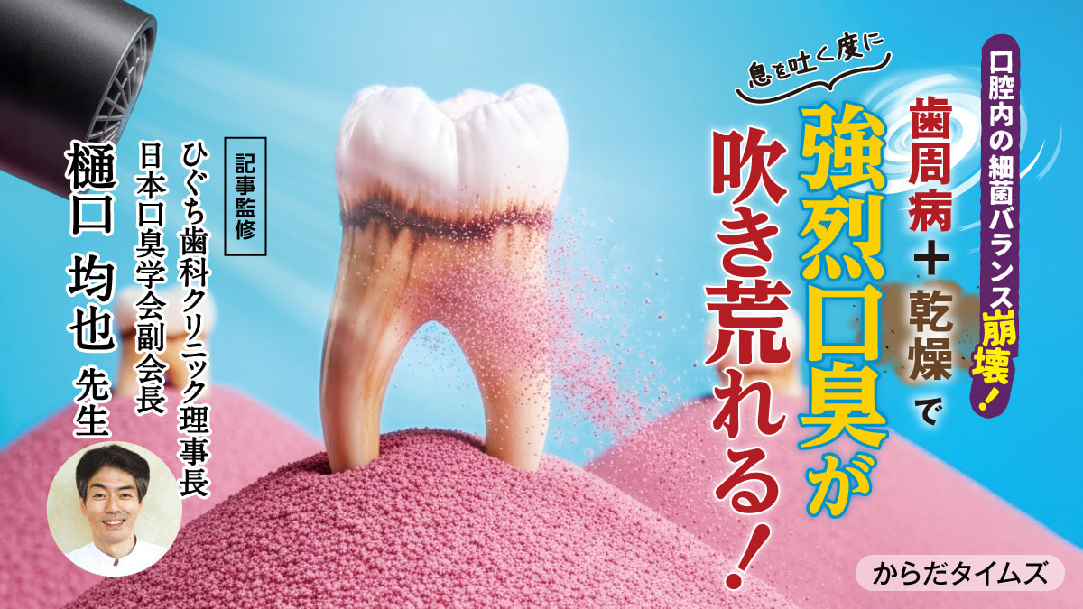 【【医師監修】口腔内のバランス崩壊！歯周病+乾燥で、息を吐く度に強烈口臭が吹き荒れる！ 